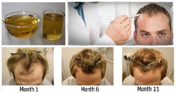 Принимайте только один ингредиент, чтобы сохранить и вырастить ваши волосы!