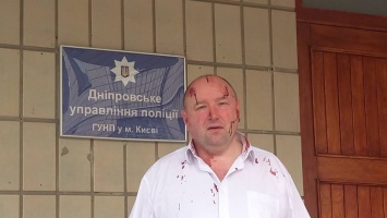 В Киеве избили правозащитника, который ведет дела о незаконных застройках