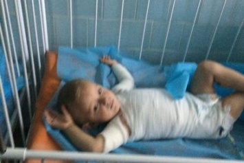 В Одессе двое малышей обварились в кипятке: нужна помощь (ФОТО)