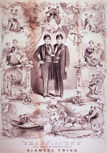 Чанг и Энг Банкер: самые известные сиамские близнецы, которые были женаты на 2-х сестрах и имели 22 детей