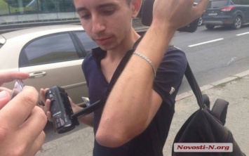 Сегодня в Николаеве журналист пострадал от рук маршрутчика