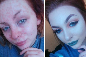 Бьюти-блогер с псориазом до и после макияжа