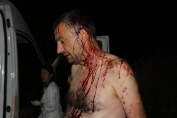 В Одесской области битами избили журналиста