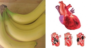 5 проблем со здоровьем, которые вы можете исцелить с помощью бананов вместо медикаментов