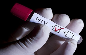 Запорожцев зовут бесплатно пройти быстрые тесты на ВИЧ