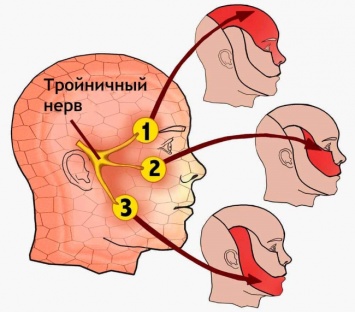 Забудете про гайморит и проблемы тройничного нерва - без лекарств!