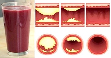 10 продуктов, которые помогут предотвратить блокировку артерий