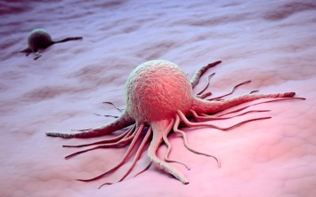 Три малоизвестных фактора при лечении рака