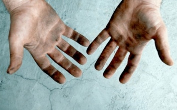 Болезнь грязных рук: на Днепропетровщине ожидается вспышка болезни Боткина