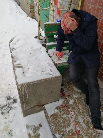 В центре Киева мужчину избили и ограбили прямо у пункта полиции