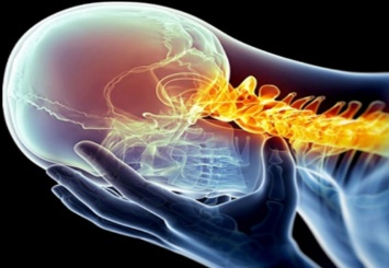 Как лечить шейную мигрень?