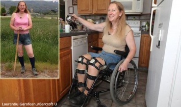 Женщина, которая может ходить, просит доктора парализовать ей ноги! Но зачем?