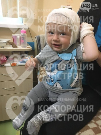 В Одессу доставили малыша, который опрокинул на голову кипяток, - ФОТО