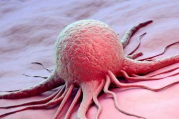 Ученые выявили легко устранимую причину рака