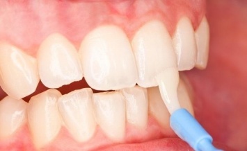 Химики разработали технологию для восстановления костей и зубной эмали