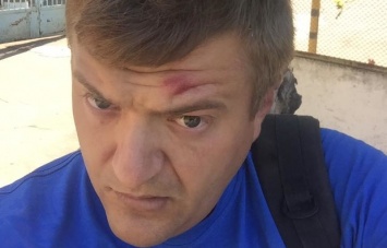 В Херсоне избили журналиста