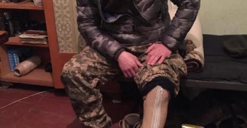Боец ВСУ положил оторванную взрывом ногу в рюкзак и продолжал огонь по террористам, - ФОТО