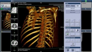 Ученые научились делать цветной 3D-рентген