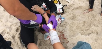 Акула атаковала детей на популярном курорте: фото