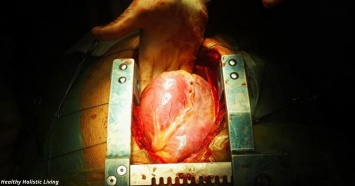 Я - кардиохирург, и я знаю главные причины болезней сердца. Вот они