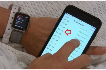 Apple Watch спас жизнь, уведомив пользователя о проблеме с сердцем