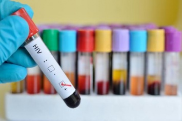 «Главная тайна 21 века»: ВИЧ - случайно появившееся заболевание или последствие теории заговора?