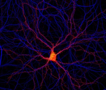 Открыт новый вид нейронов