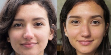 «До и после». Девушка отказалась от веганства и показала разницу на фото