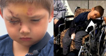 6-летний малыш заступился за друг - и был жестоко избит. Но герой же!