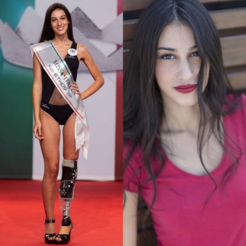 Одноногая девушка стала финалисткой конкурса "Мисс Италия". Фото