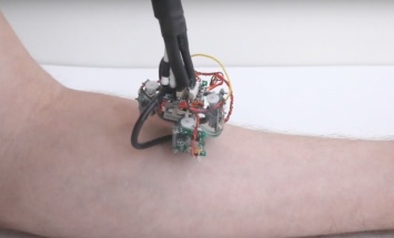 Разработан робот, который шагает по коже, изучая ее состояние (ВИДЕО)