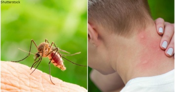 Если после укуса комара у вас набухает кожа, это может быть синдром Скитера
