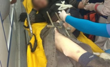На Днепропетровщине мужчина проткнул себе ногу металлическим прутом (ФОТО)