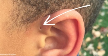 Вот почему некоторые рождаются с крошечными отверстиями в ушах