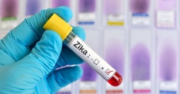 Вирус Зика: симптомы, лечение и последствия