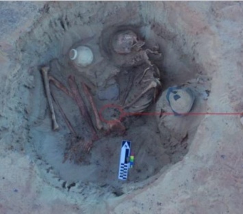 По найденным скелетам египтянки и плода археологи определили причину смерти при родах