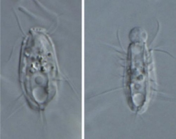 Ученые открыли уникальный вид микробов-каннибалов из царства эукариотов