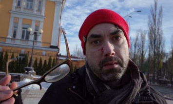 В Киеве противники марша в поддержку трансгендерных людей избили канадского журналиста