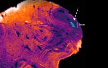 В человеческом мозге нашли неизвестный участок