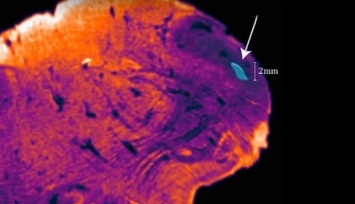 В человеческом мозге найден неизвестный участок